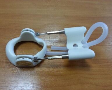 Extender after an operation to increase member