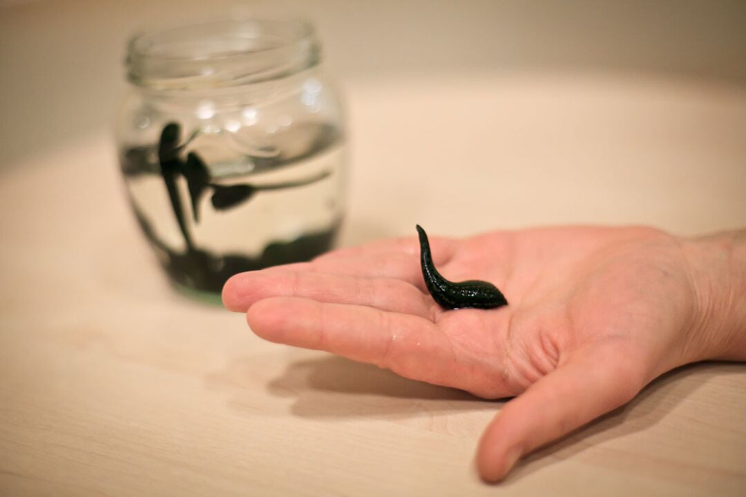 Leeches will serve as raw material for the production of creams that stimulate penis enlargement